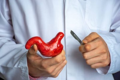 Banding Surgeon held scalpel over anatomical model of human stomach, holding it in his hand against background of body in a white uniform. Concept photo surgical treatment of stomach ailments and procedures